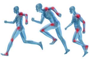 Sports Physiotherapy